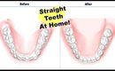 How To Get Straight Teeth At Home | Invisible Aligners Update