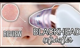 REMOVE BLACKHEADS NATURALLY | Project E Beauty | Caitlyn Kreklewich