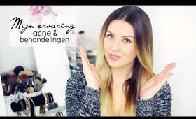 MIJN ERVARING | ACNE & BEHANDELINGEN