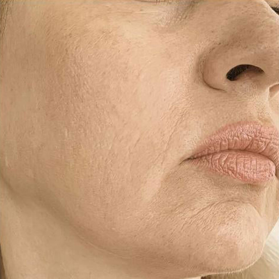 Glamcor's Riki Sculptress Mini targets sagging skin