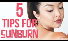 HOW TO: Get Rid of Sunburn FAST!