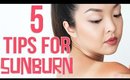HOW TO: Get Rid of Sunburn FAST!
