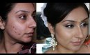 Updated foundation routine cover acne cystic acne blemishes tutorial | Makeup With Raji