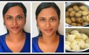 Instant Skin Lightening Potato Mask | For Pigmentation & Acne Scars