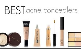 THE BEST CONCEALERS FOR ACNE PRONE SKIN!