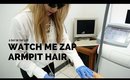 IPL HAIR REMOVAL ARMPIT | A Day In The Life