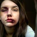 Casualty Effects