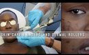 Removing Hyper Pigmentation | Lasers vs Skin Needling Which do I prefer NEW SKin care methods