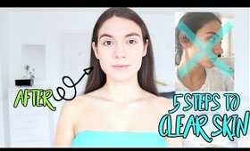 5 STEPS To Get Rid Of Acne FOREVER !