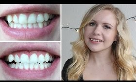 How To Get White and Bright Teeth - Fast and Easy 2015