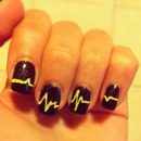 heartbeat nails