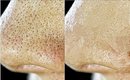 How to _ Get Rid Of LARGE Open PORES? _ | (GET Younger, Smoother & Tighter Skin!)