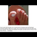 Nails tip