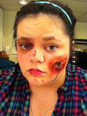 Injury Makeup: Third Degree Burn, Black Eye, Scraps and such.