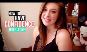 How to Have Confidence with Acne!