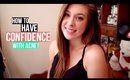 How to Have Confidence with Acne!