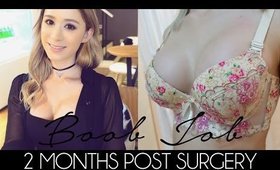 MY BOOB JOB RECOVERY | 2 Months Post Surgery