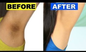 How To Lighten Dark Underarms Permanently | Skincare Routine | ShrutiArjunAnand