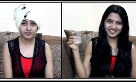 Dandruff Treatment at Home !! - Best Winter Remedy & Care - Severe Lemon Vinegar Remedies Naturally