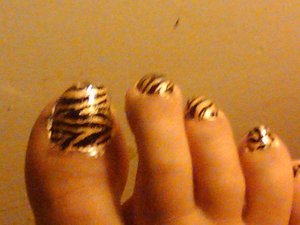 zebra toenails 