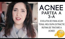 ACNEE Partea III: Tenul meu dupa extractie & creme folosite