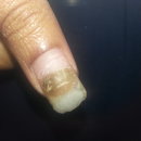 My nail needs help !