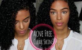 How to: Maintain Clear & Acne Free Skin  | SunKissAlba