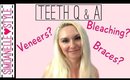 Teeth Q & A - Whitening, Braces, Veneers | SimDanelleStyle