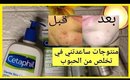 منتجات الي ساعدتني لتخلص من حب الشباب (acne) 🤓 روتيني عنايتي بالبشرة اليومي