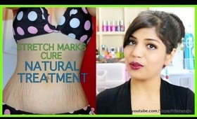 How To Treat Stretch Marks,Prevent,Cure,Pregnancy Stretch Marks Home Remedy Natural Treatment