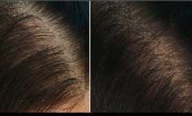 6 Tips to _ STOP Hair Fall & Grow Hair Faster! _ (Prachi SuperWowStyle)
