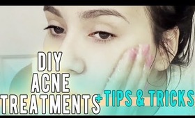 DIY ACNE HOME REMEDIES / TREATMENTS , TIPS , AND TRICKS!