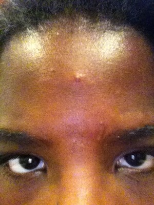 Crack In The Middle Of My Forehead