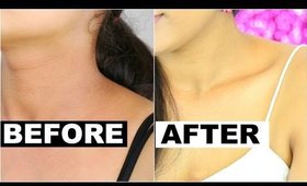 How to Get Rid of Dark Neck Instantly | Skincare Routine | ShrutiArjunAnand