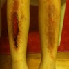 Gory Leg Makeup
