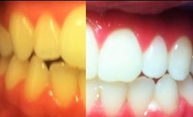 Teeth Whitening At Home - With Salt! _ (Natural Beauty Hacks - Part 3) | SuperWowStyle