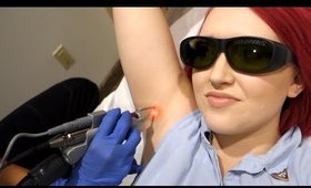 Brazillian & Underarm Laser Hair Removal- My Experience! (1st Session)