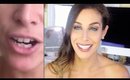 Straight Beautiful Teeth AT HOME | Final RESULTS | Smile Direct Club