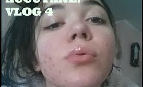 Accutane: Vlog 4 | Update | New Lighting