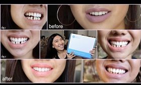 HOW TO: Whiten Your Teeth At Home + GIVEAWAY