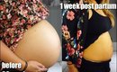 Baby Update - One Week Post Partum - Before and After Belly Shots