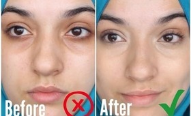 HOW TO CONCEAL DARK CIRCLES