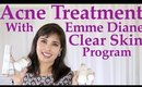 How I Cleared My Acne With Emme Diane's Clear Skin Program