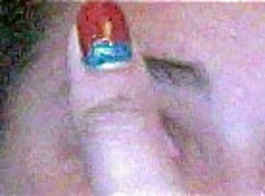 See this was an accident. My finger was wedge between a closing door and the wall and caused my nail to split after the healing the nail was still broken and I had to paint it two different color to hide the boo boo.. ouch. 