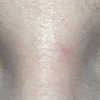 My eyes today 