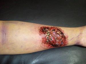 I created this prosthetic, then applied it to my arm. Used common colors to create a "zombie look"
