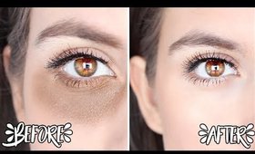 How to Remove Dark Circles Naturally OVERNIGHT !