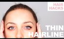 Thinning Hairline | Milk + Blush Hair Hacks