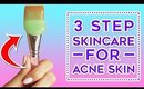 HOW TO: CLEAR ACNE SKIN IN 60 SECONDS | Ep. 4