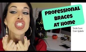 Professional Braces At Home | Perfect Straight Teeth | Smile Care Club Update